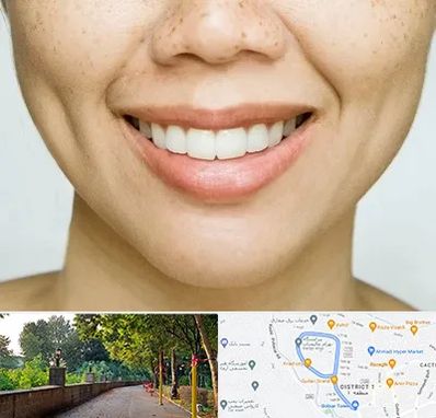 عمل چال گونه در بلوار گیلان رشت