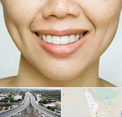 عمل چال گونه در اندیمشک