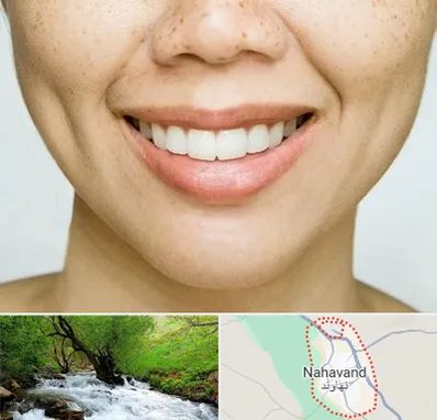 عمل چال گونه در نهاوند