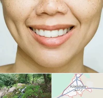 عمل چال گونه در آزادشهر