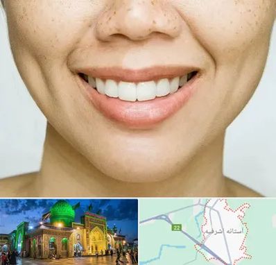 عمل چال گونه در آستانه اشرفیه