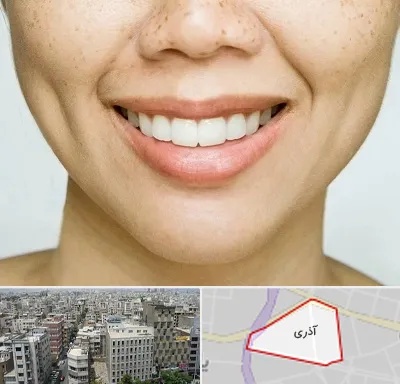 عمل چال گونه در آذری