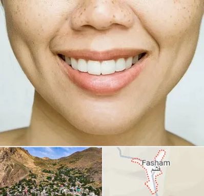 عمل چال گونه در فشم