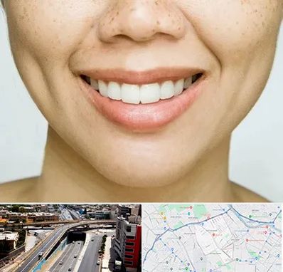 عمل چال گونه در ستارخان شیراز