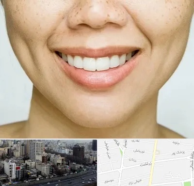 عمل چال گونه در زرتشت