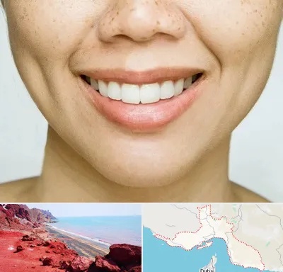 عمل چال گونه در هرمزگان