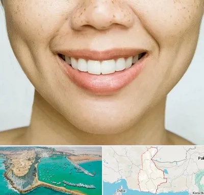 عمل چال گونه در سیستان و بلوچستان