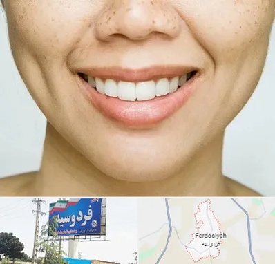 عمل چال گونه در فردوسیه شهریار