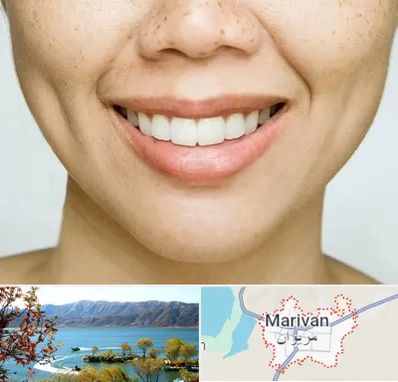 عمل چال گونه در مریوان