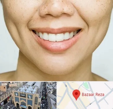 عمل چال گونه در بازار رضا مشهد