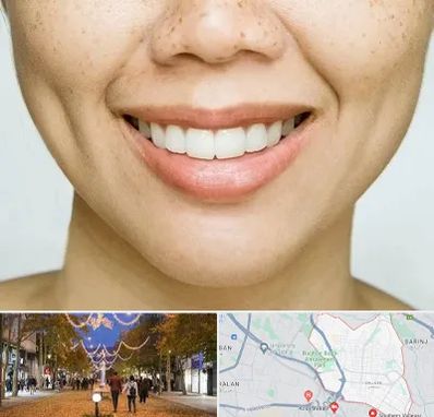 عمل چال گونه در ولیعصر ارومیه