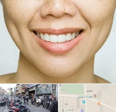 عمل چال گونه در چهارراه استانبول