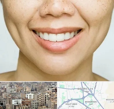 عمل چال گونه در جنوب شرق تهران