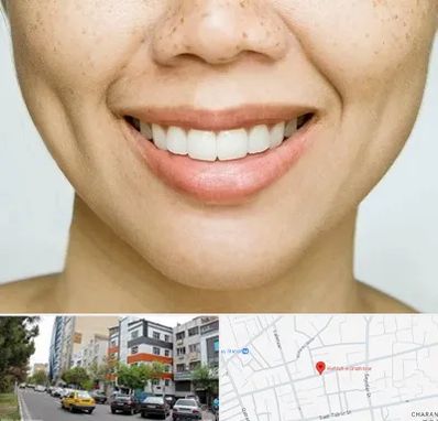 عمل چال گونه در هفده شهریور تبریز