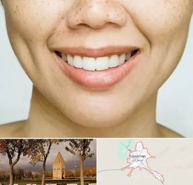 عمل چال گونه در تویسرکان