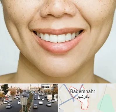 عمل چال گونه در باقرشهر