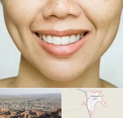 عمل چال گونه در اسفراین