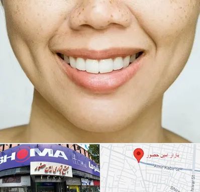 عمل چال گونه در امین حضور