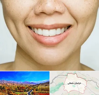 عمل چال گونه در خراسان شمالی