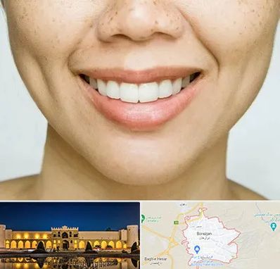 عمل چال گونه در برازجان