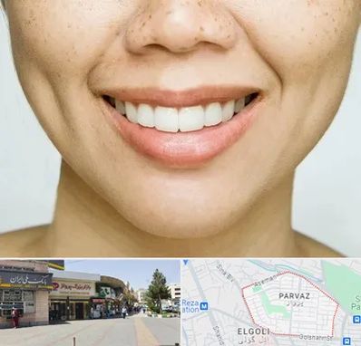 عمل چال گونه در پرواز تبریز