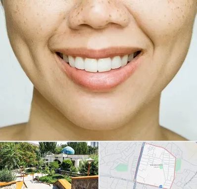 عمل چال گونه در باغمیشه تبریز