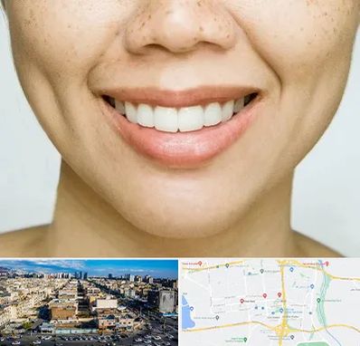 عمل چال گونه در شهرک راه آهن