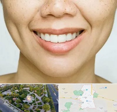 عمل چال گونه در کاشمر