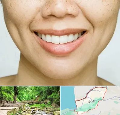 عمل چال گونه در گلستان