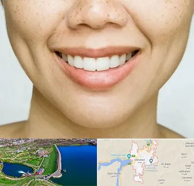 عمل چال گونه در مهاباد