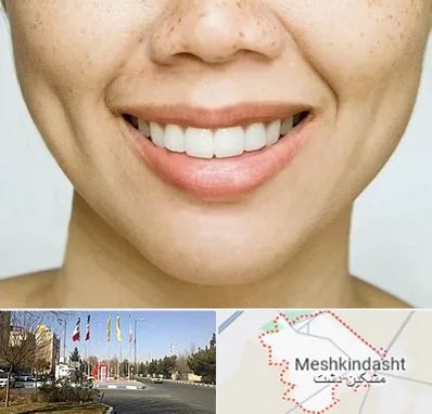 عمل چال گونه در مشکین دشت