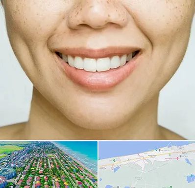 عمل چال گونه در فریدونکنار