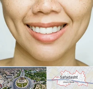 عمل چال گونه در صفادشت