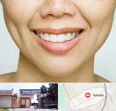 عمل چال گونه در وحیدیه شهریار