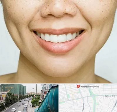 عمل چال گونه در بلوار فرحزادی