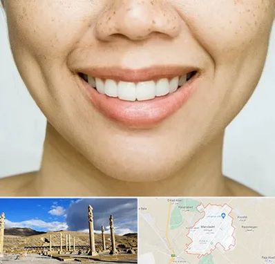 عمل چال گونه در مرودشت