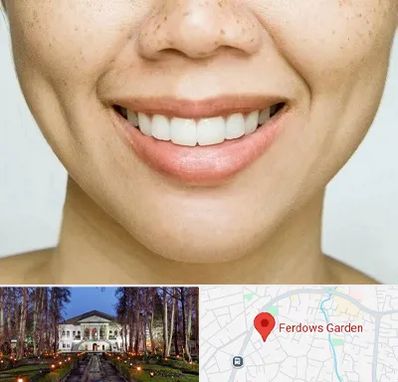 عمل چال گونه در باغ فردوس