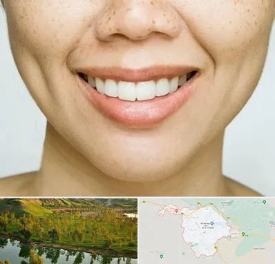 عمل چال گونه در بهبهان