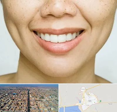 عمل چال گونه در بندر ماهشهر