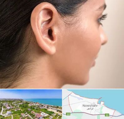 عمل گوش بل در نوشهر