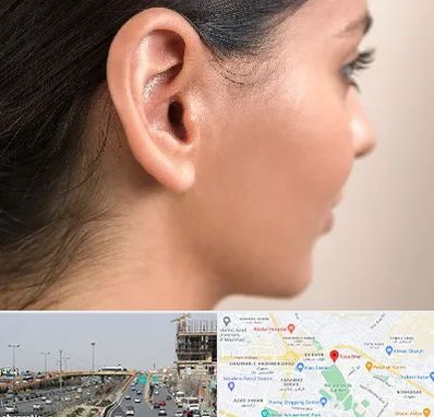 عمل گوش بل در بلوار توس مشهد