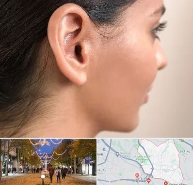 عمل گوش بل در ولیعصر ارومیه