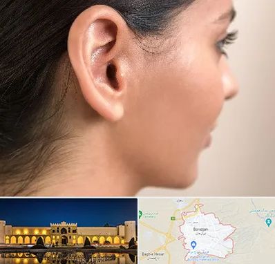 عمل گوش بل در برازجان