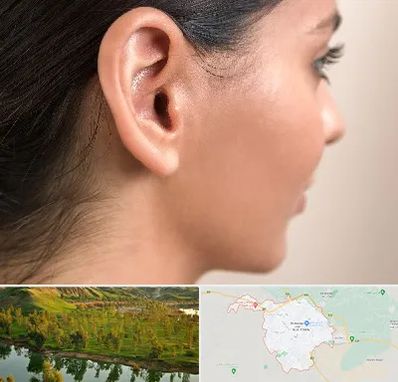 عمل گوش بل در بهبهان