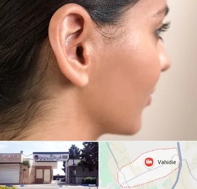 عمل گوش بل در وحیدیه شهریار