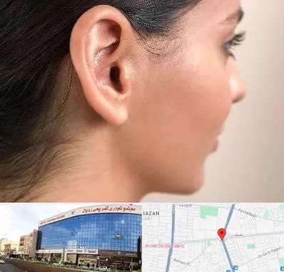 عمل گوش بل در نصف راه تبریز