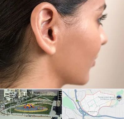 عمل گوش بل در مرزداران تبریز