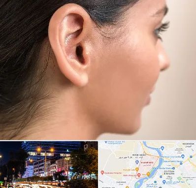 عمل گوش بل در کیانپارس اهواز