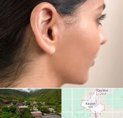 عمل گوش بل در کلاله
