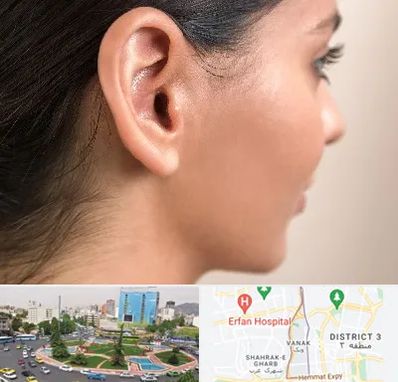 عمل گوش بل در ونک 